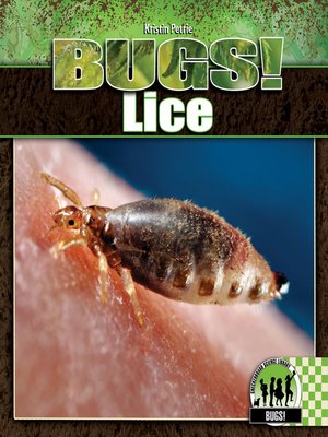 cover image of Lice
